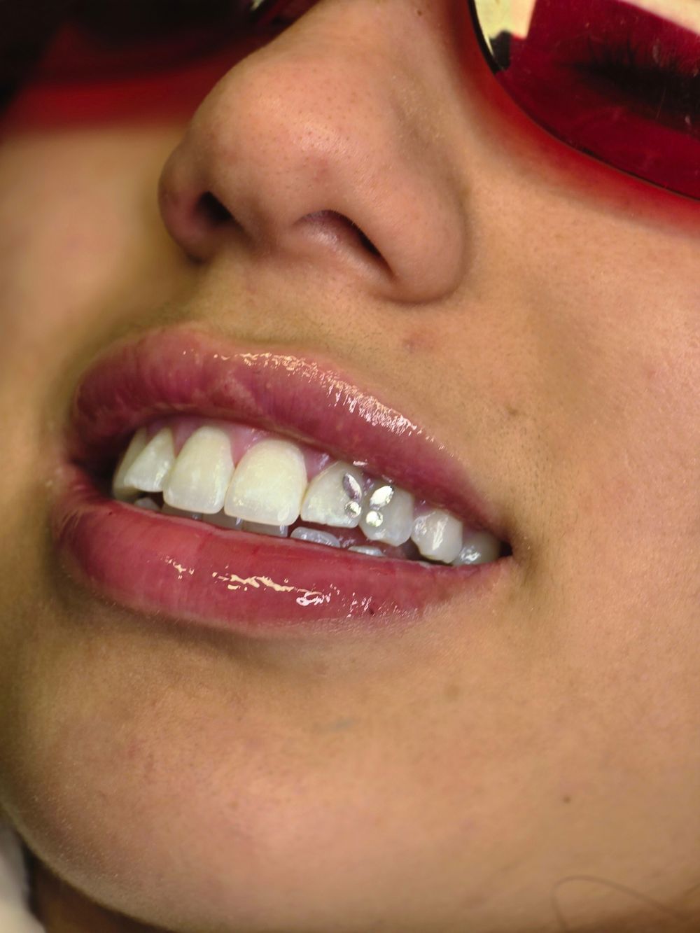 Joya dental